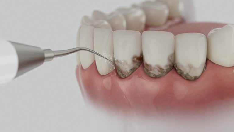 Trusted Dental Implants service in Parrish, AL - Dentist Open Now